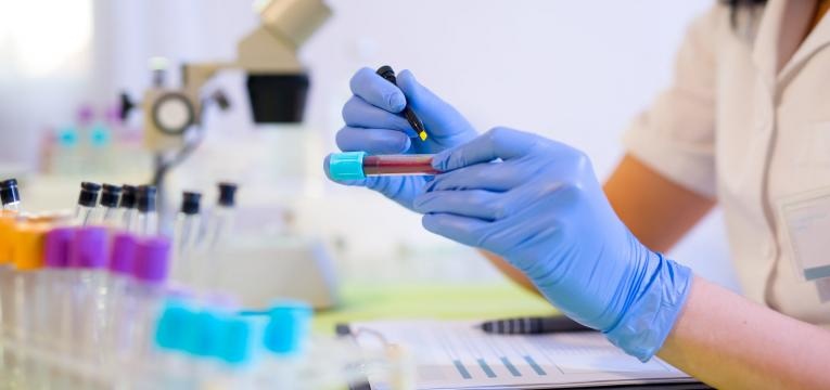 linfocitose analise ao sangue