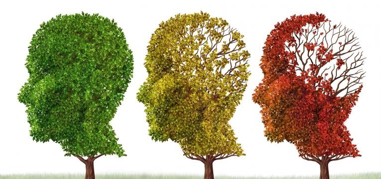 Alzheimer perda de memoria