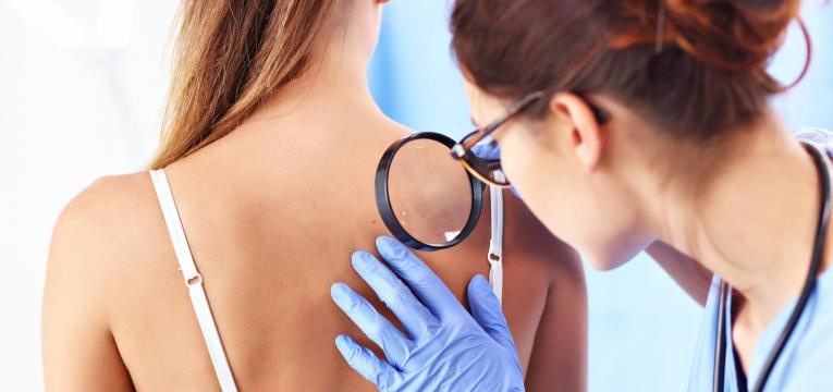 alergia ao sol dermatologista a observar pele