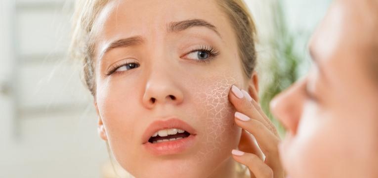 pele desidratada mulher com pele seca