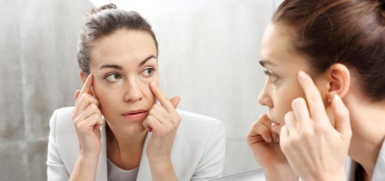 papos nos olhos mulher a ver as olheiras