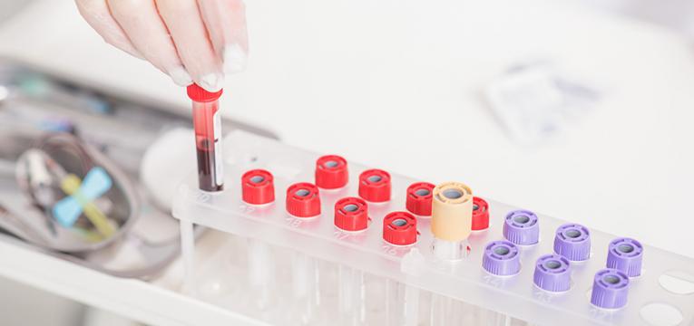 exames de sangue em jejum