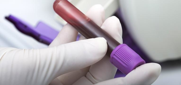 analise bioquimica ao sangue materno