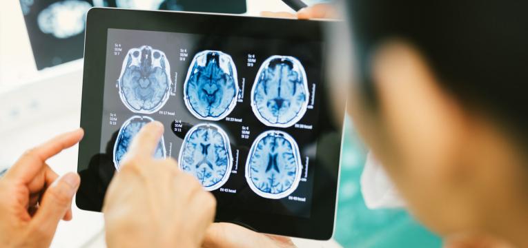 melhoria da funcao cerebral