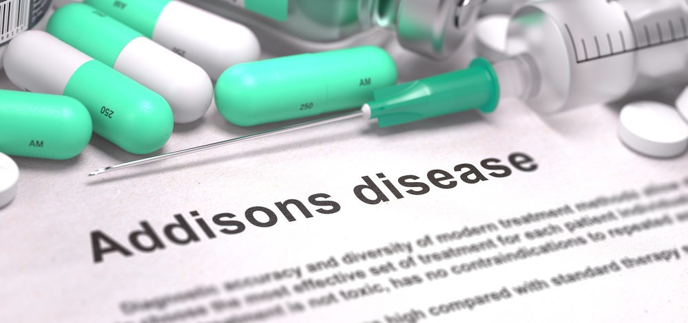 Doença de Addison: sintomas, diagnóstico e tratamento
