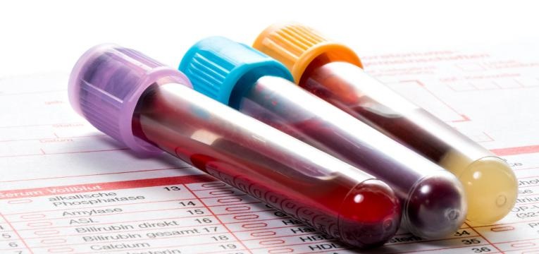 alergia e intolerancia e analise ao sangue